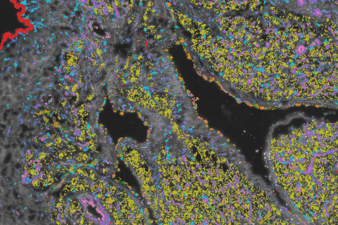 A scan of a right atrial tissue (Credit: Kellis Lab).